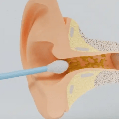 WaxClean™ - Smart Ear Cleaning With Advanced Technology
